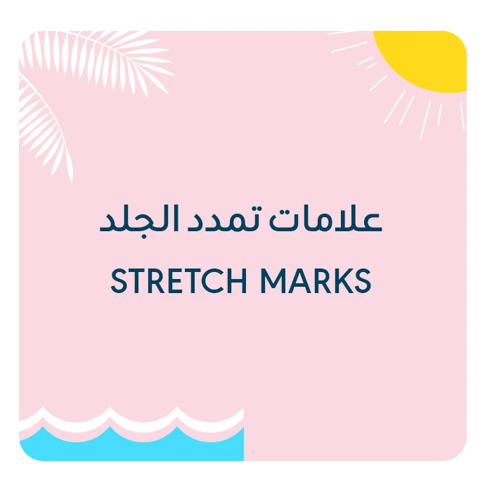 Stretch Marks