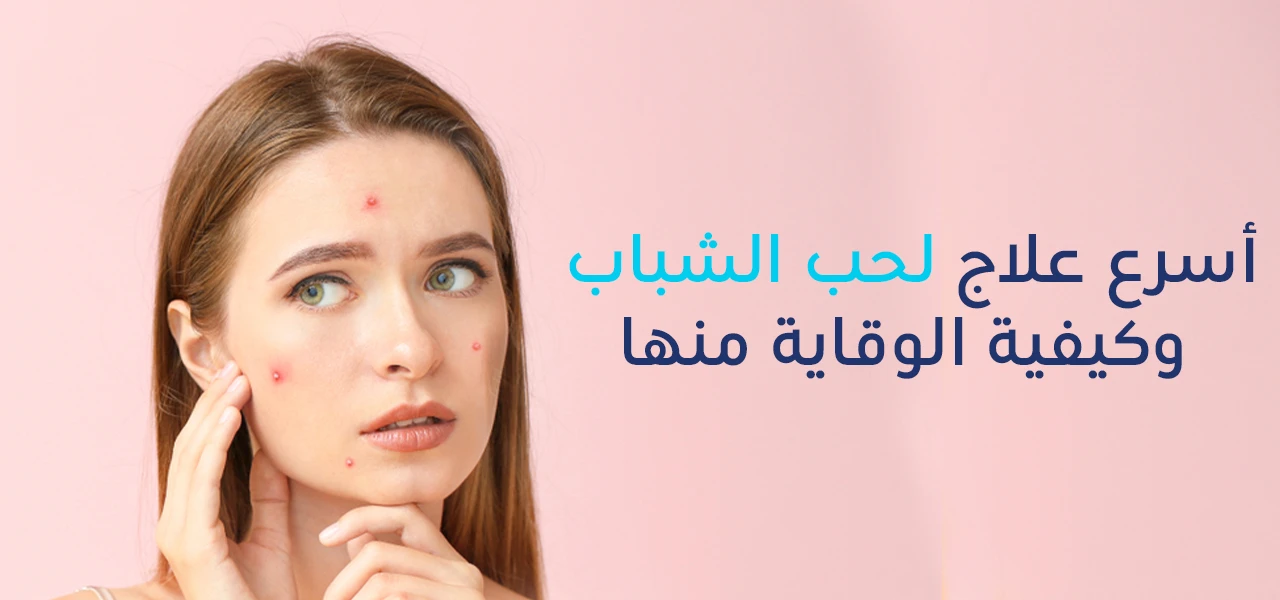 How to Cure Acne and the Best Ways to Treat