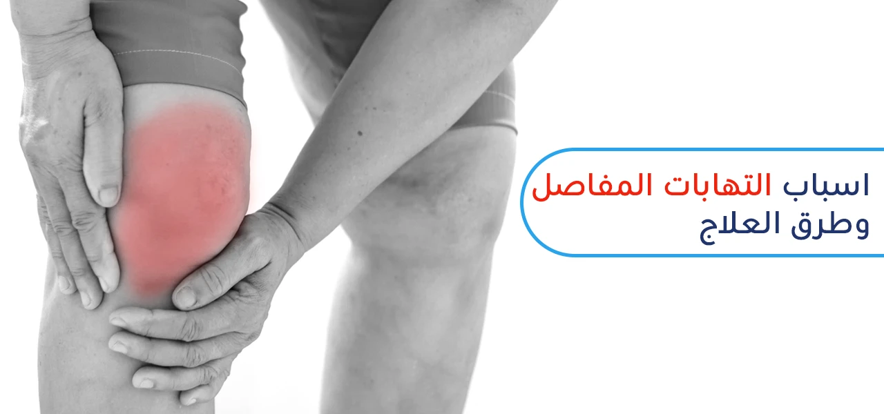 What is arthritis and what ways of treating it?